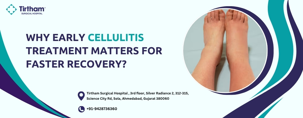 Why Early Cellulitis Treatment Matters for Faster Recovery