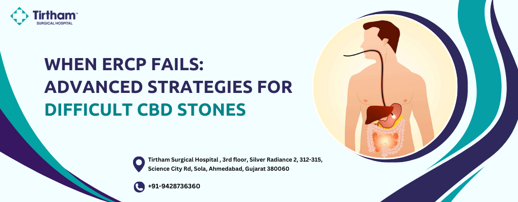 When ERCP Fails: Advanced Strategies for Difficult CBD Stones