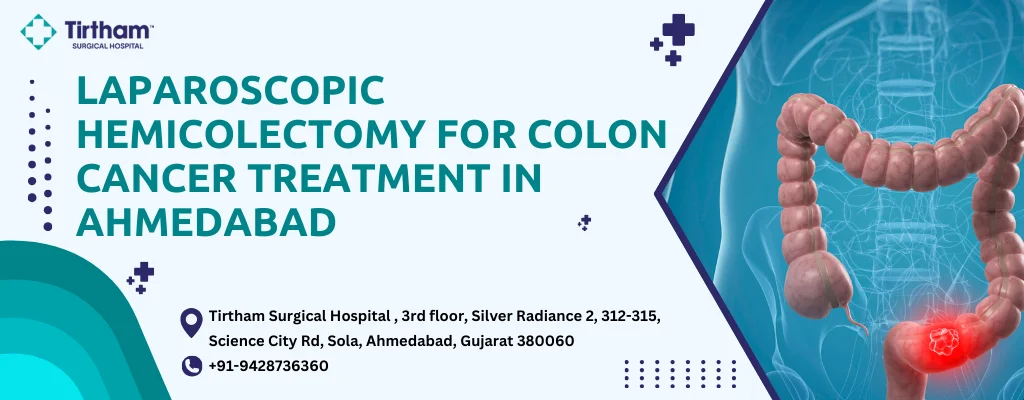 Lap Hemicolectomy for Colon Cancer