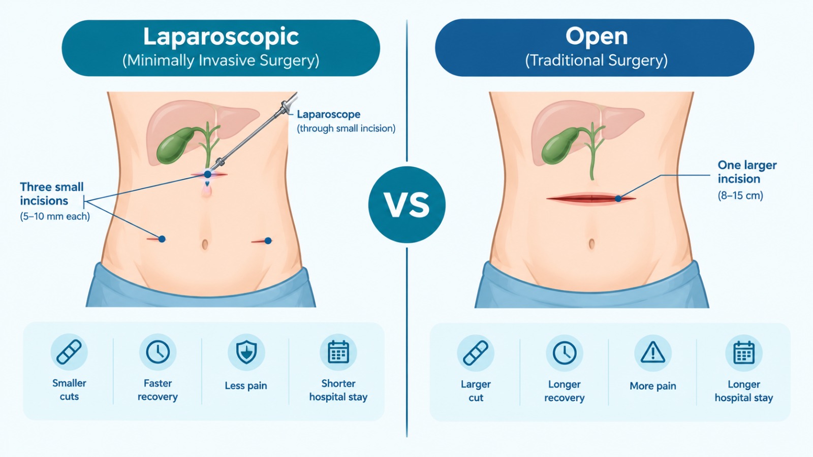 Laparoscopic compared with open gallbladder surgery