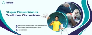 Stapler Circumcision vs. Traditional Circumcision