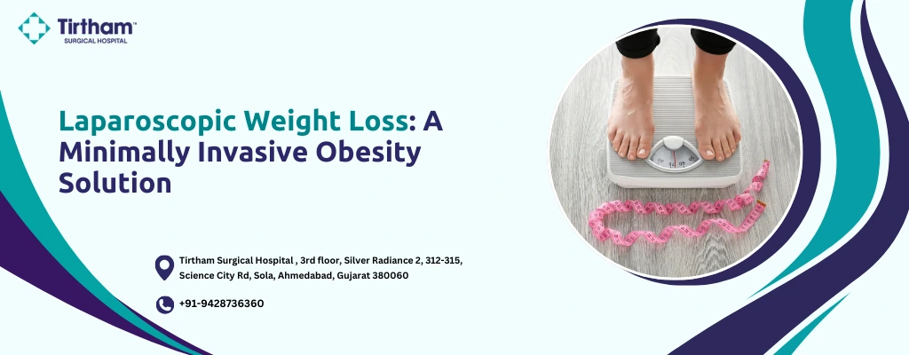 Laparoscopic Weight Loss Surgery in Ahmedabad