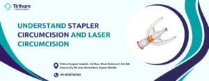 Undersatnd Stapler Circumcision and Laser Circumcision