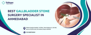 Best Gallbladder Stone Surgery Specialist in Ahmedabad
